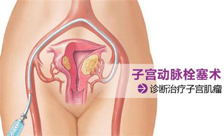 20140901031517289.jpg