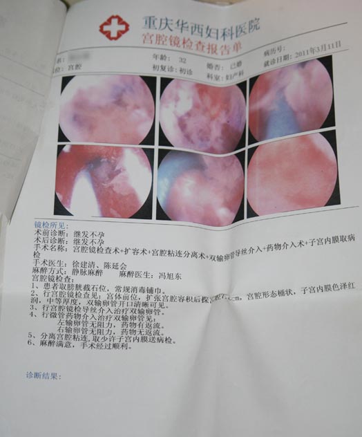 宫腔镜检查报告